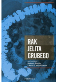 Rak jelita grubego