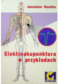Elektroakupunktura w przykładach
