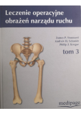 Leczenie operacyjne obrażeń narządu ruchu Tom 3