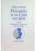 Hemophilia in the Child and Adult