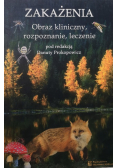 Zakażenia Obraz kliniczny rozpoznanie  leczenie