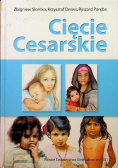Cięcie cesarskie
