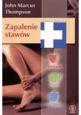 Zapalenie stawów
