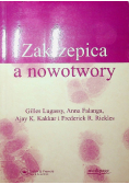 Zakrzepica a nowotwory