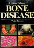 A Colour Atlas Of Bone Disease