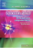 Próchnica zębów Choroba próchnicowa i postępowanie kliniczne