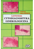 Cytodiagnostyka ginekologiczna