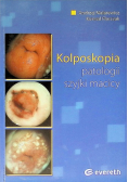 Kolposkopia patologii szyjki macicy