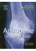 Artropatie w czerni i bieli