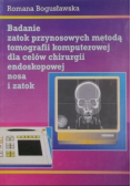 Badanie zatok przynosowych metodą tomografii komputerowej