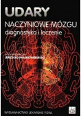 Udary naczyniowe mózgu diagnostyki i leczenie
