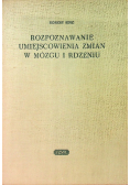 Rozpoznawanie umiejscowienia zmian w mózgu i rdzeniu