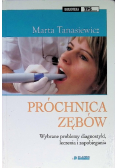 Próchnica zębów wybrane problemy diagnostyki leczenia i zapobiegania