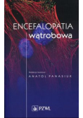 Encefalopatia wątrobowa