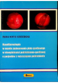 Nasofiberoskopia w ocenie zastosowania płata gardłowego w niewydolności podniebieniowo-gardłowej
