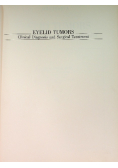 Eyelid tumors Clinical Diagnosis and Surgical Treatment