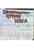 Zaburzenia rytmu serca