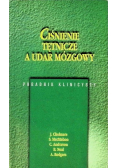 Ciśnienie tętnicze a udar mózgowy