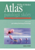 Atlas patologii skóry