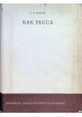 Rak płuca