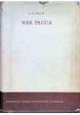 Rak płuca