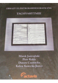 Obrazy elektrokardiograficzne tachyarytmie
