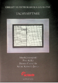 Obrazy elektrokardiograficzne tachyarytmie