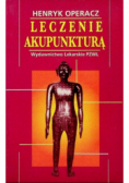 Leczenie akupunkturą