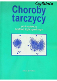 Choroby tarczycy