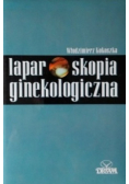 Laparoskopia ginekologiczna