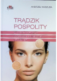 Trądzik pospolity