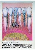 Atlas wszczepów dentystycznych