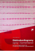 Elektrokardiogramy opisy i komentarze
