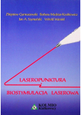 Laseropunktura i biostymulacja laserowa