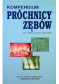 Próchnica zębów Kompendium