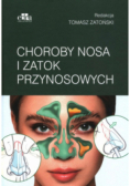 Choroby nosa i zatok przynosowych