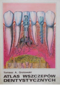 Atlas wszczepów dentystycznych
