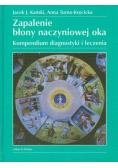 Zapalenie błony naczyniowej oka