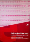 Elektrokardiogramy opisy i komentarze