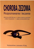 Choroba zezowa