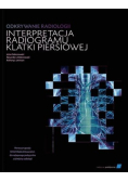 Odkrywanie radiologii: interpretacja radiogramu klatki piersiowej