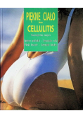 Piękne ciało bez cellulitis