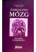 Żarłoczny mózg Pułapki uzależnień