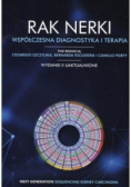 Rak nerki Współczesna diagnostyka i terapia