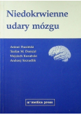Niedokrwienne udary mózgu