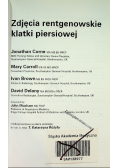 Zdjęcia rentgenowskie klatki piersiowej