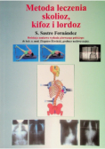 Metoda leczenia skolioz kifoz i lordoz