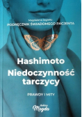 Hashimoto niedoczynność tarczycy