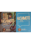 Pakiet hashimoto