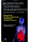 Nowotwory przewodu pokarmowego